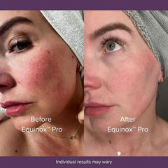 Masque LED Equinox™ Pro