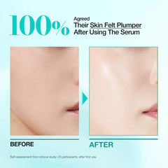 ANUA 100 sérum pdrn acide hyaluronique